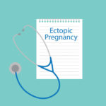 الحمل خارج الرحم الدليل الشامل للأسباب والأعراض والتشخيص والعلاج